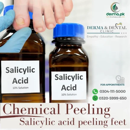 Peeling with Salicylic Acid