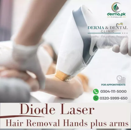 scientific-diode-laser-hair-removal-for-hands-and-arms-659317ca4cd26